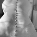 treatment