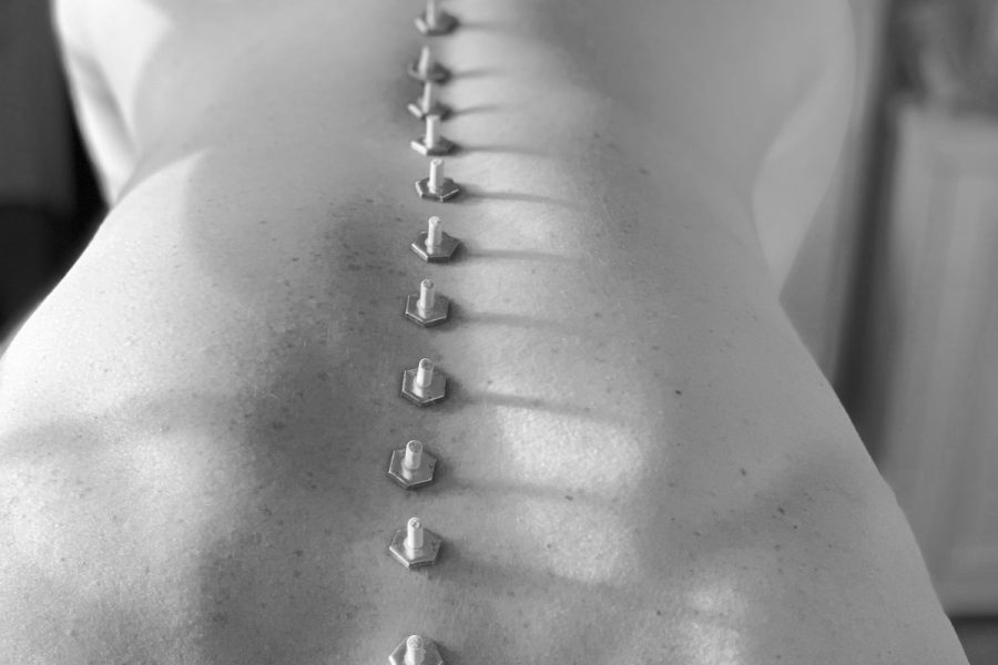 treatment